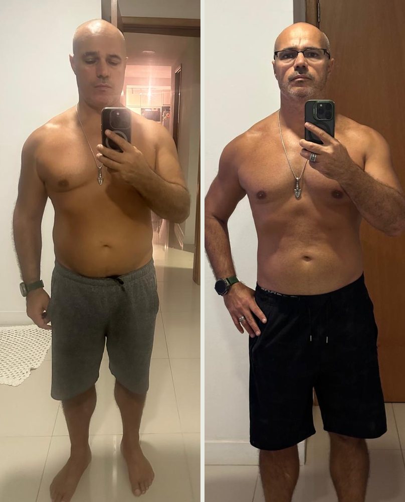 Everton antes e depois