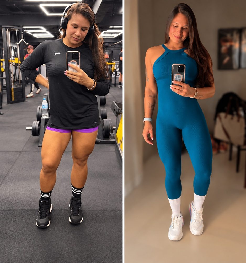 Louise antes e depois